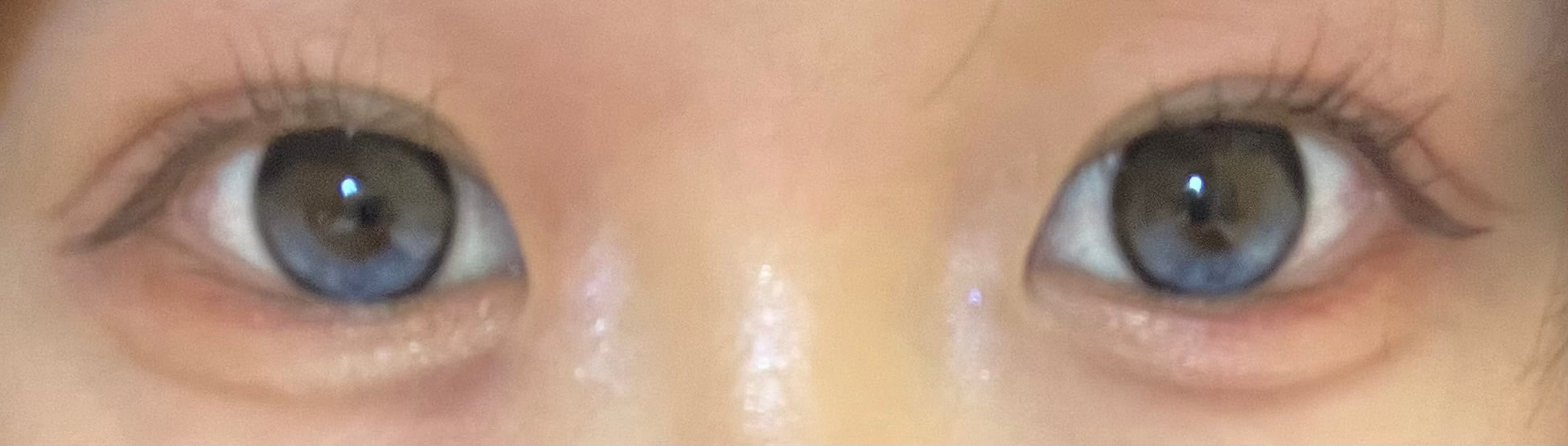 [I-SHA] リボン スカイベール 【1DAY】軸固定